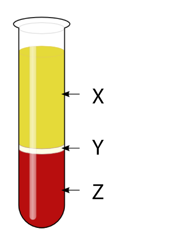 blood sperarated by centrifuge